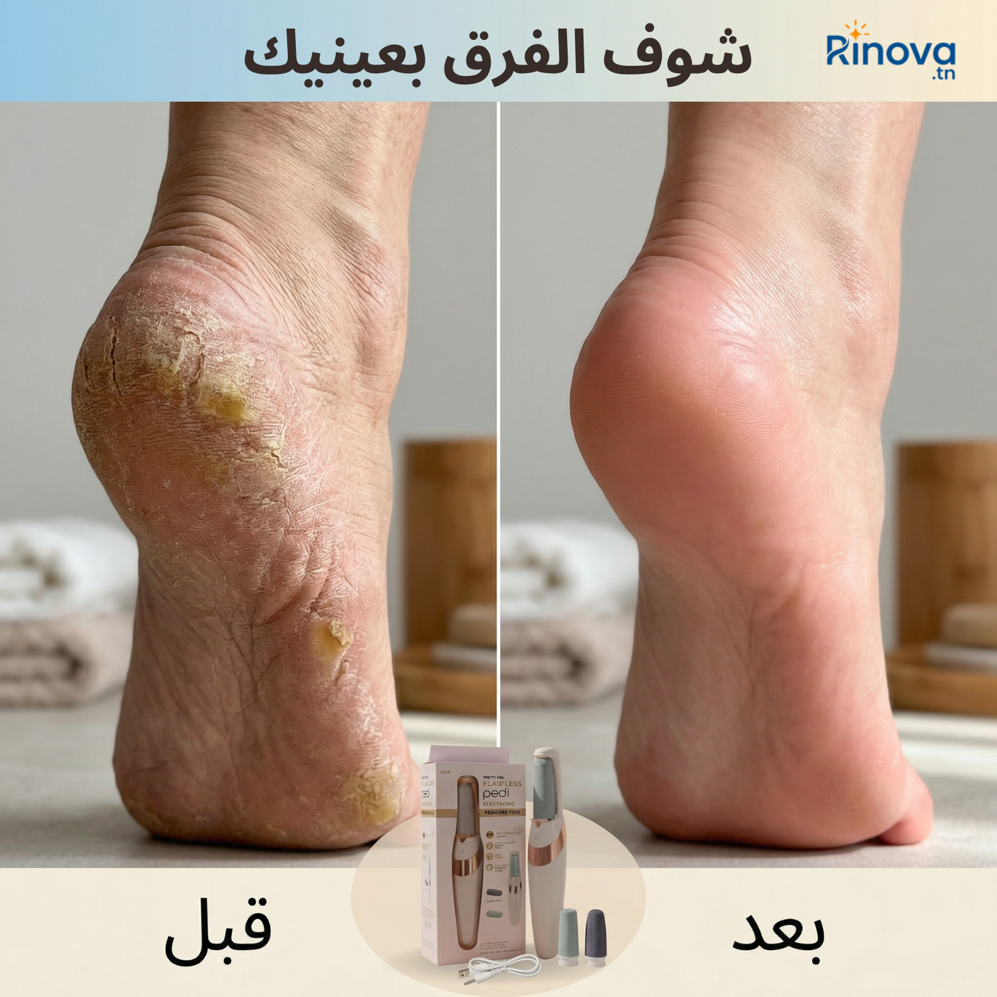 Lime À Pied Electrique Rechargeable