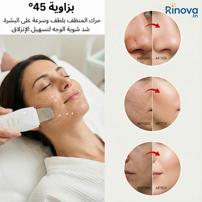 Appareil Épurateur Visage 3en1 : Nettoyage & Hydratation & Purification